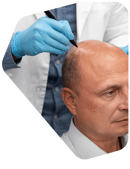 clinica-de-tricologia-avanzada.png