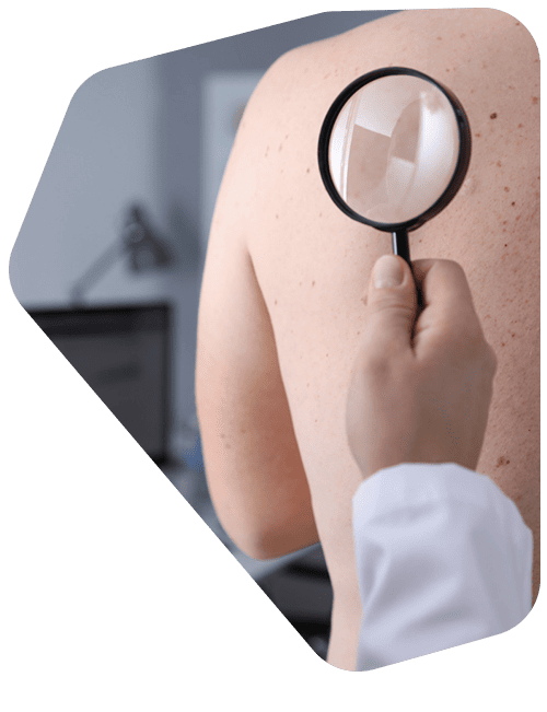 costo-de-cirugia-dermatologica.png