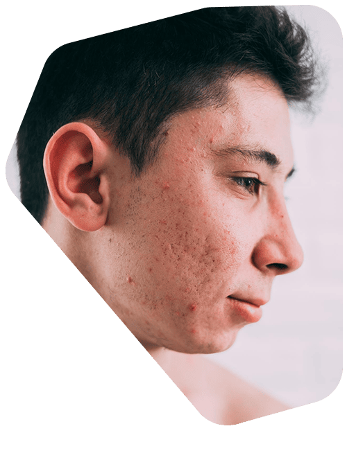 dermatologo-para-manchas-en-la-piel.png