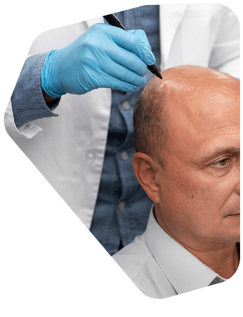 doctor-tricologo.png