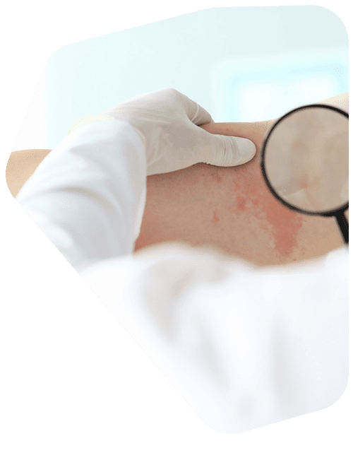 examen-de-piel-dermatologia.png
